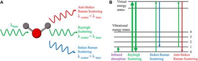 Raman Spectroscopy: A Novel Technology for Gastric Cancer Diagnosis